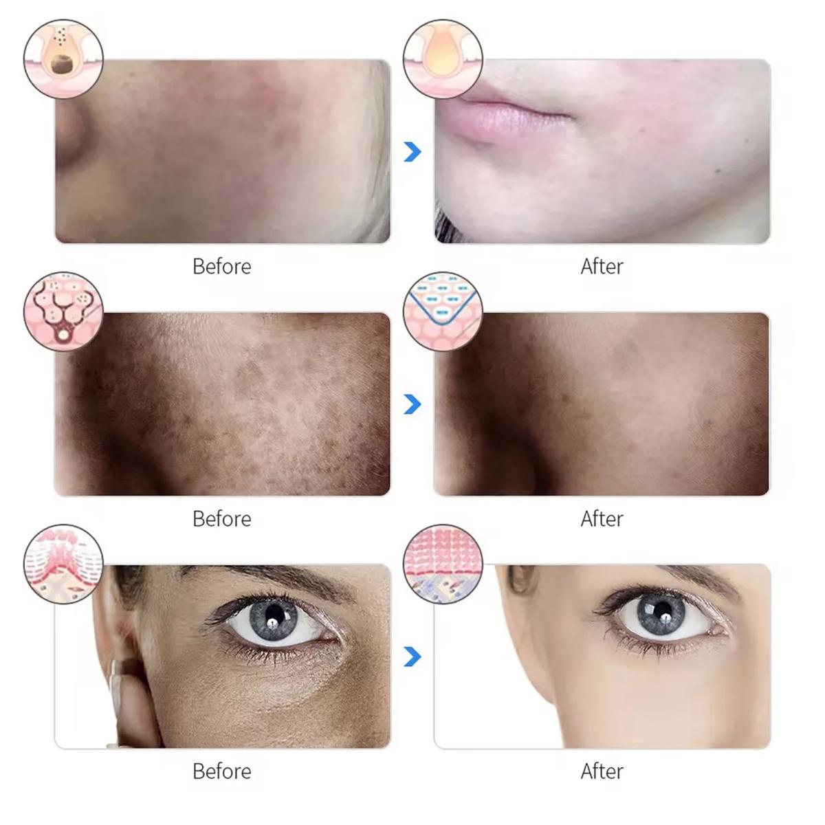 LED light therapy face mask packaging and included accessories